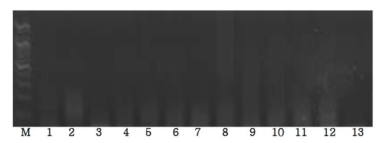 Agarose gel electrophoresis of PCR products using the Ovis D-loop primer.