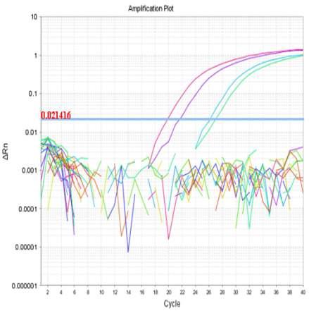 Detection of pig from halal food by real-time PCR using Sus cytochrom B primer