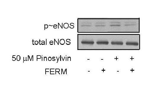 FERM의 과발현은 pinosylvin의 eNOS 인산화를 억제