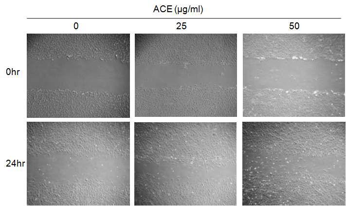 Effect of Areca catechu extract(ACE) on cell migration. Confluent monolayers of dermal fibroblast cells were wounded using a pipette tip, and the monolayer cells were treated with ACE at the indicated concentrations