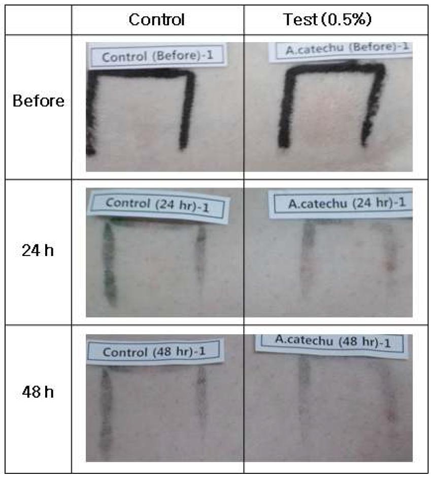 30% 1,3 Butylene glycol 및 0.5% 대복피 추출물을 토끼의 등 부위에 도포한 후의 피부 반응을 시간별과 관찰함. (A) 실험 토끼 1, (B) 실험 토끼 2, (C) 실험 토 끼 3.