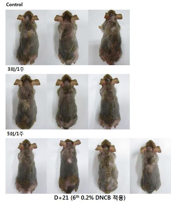 1% DNCB 및 0.2% DNCB를 21일간 NC/Nga에 처치하여 아토피를 유도한 대표적인 병변 사진들을 나타냄.