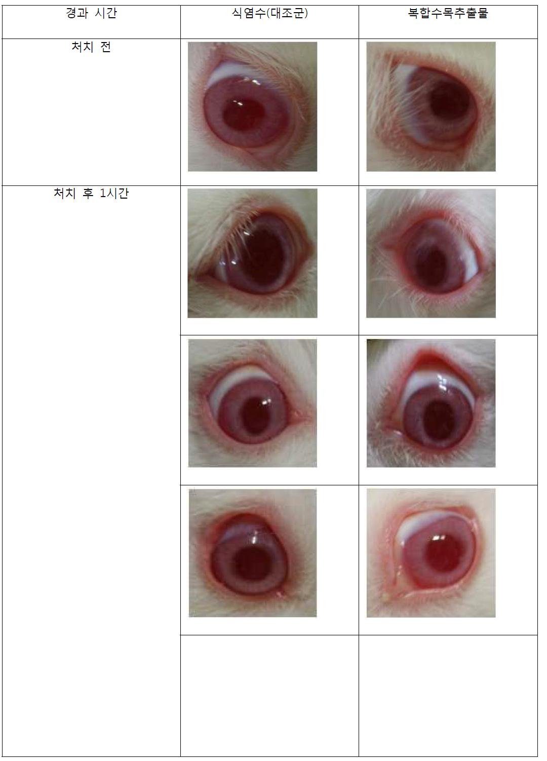 안점막 자극 시험결과