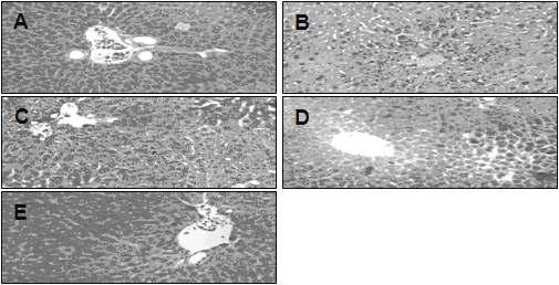 Effects of PT on acetaminophen-induced liver damage in mice.