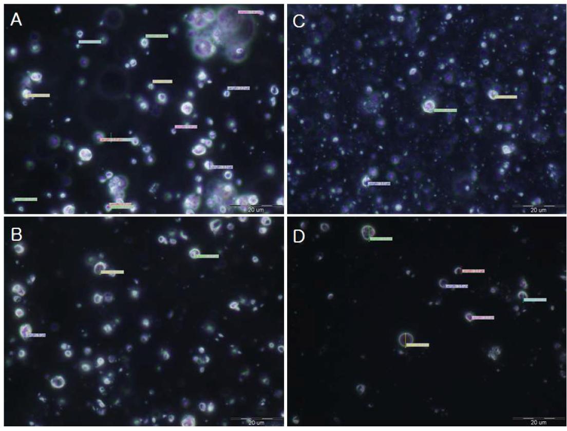 Microscope image of aminoolipid surfactant & nonionic surfactant cream (4)