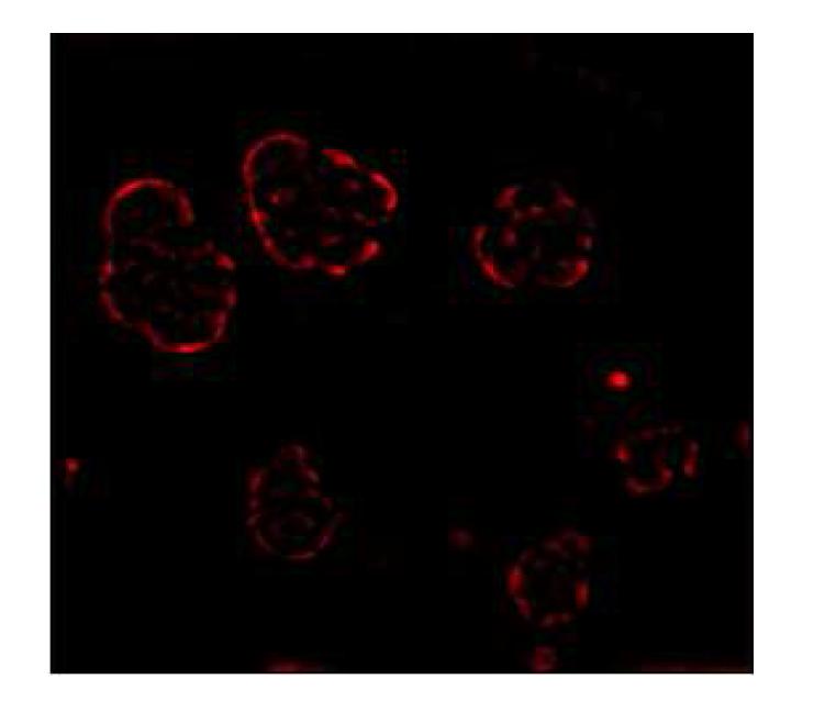 Confocal laser scanning microscopy image of nile red loaded ANM cream