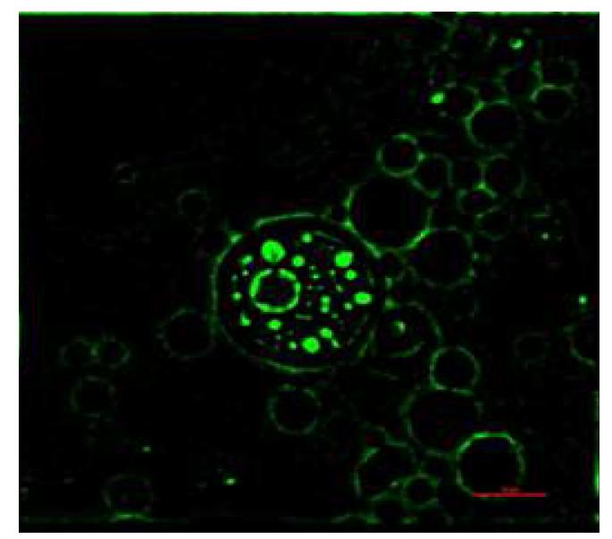 Confocal laser scanning microscopy image of fluorescein loaded ANM cream