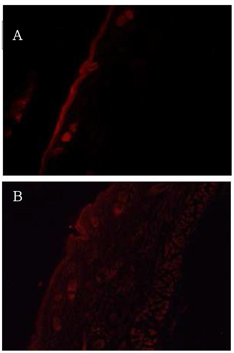 Confocal laser scanning microscopy image of nile red loaded ANM cream