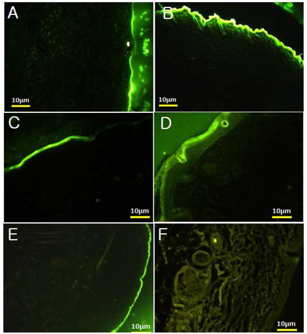 Confocal laser scanning microscopy image of fluorescein loaded ME DDS in mice skin.