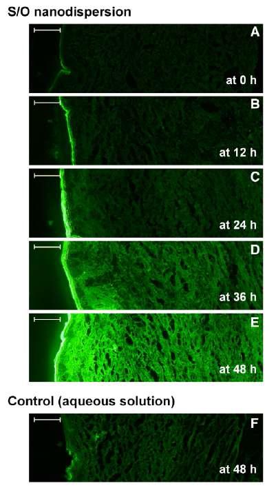 Fluorescence microscopy of the skin sections treated with the samplescontaining FITC-labeled insulin visualized through a 10x objective.