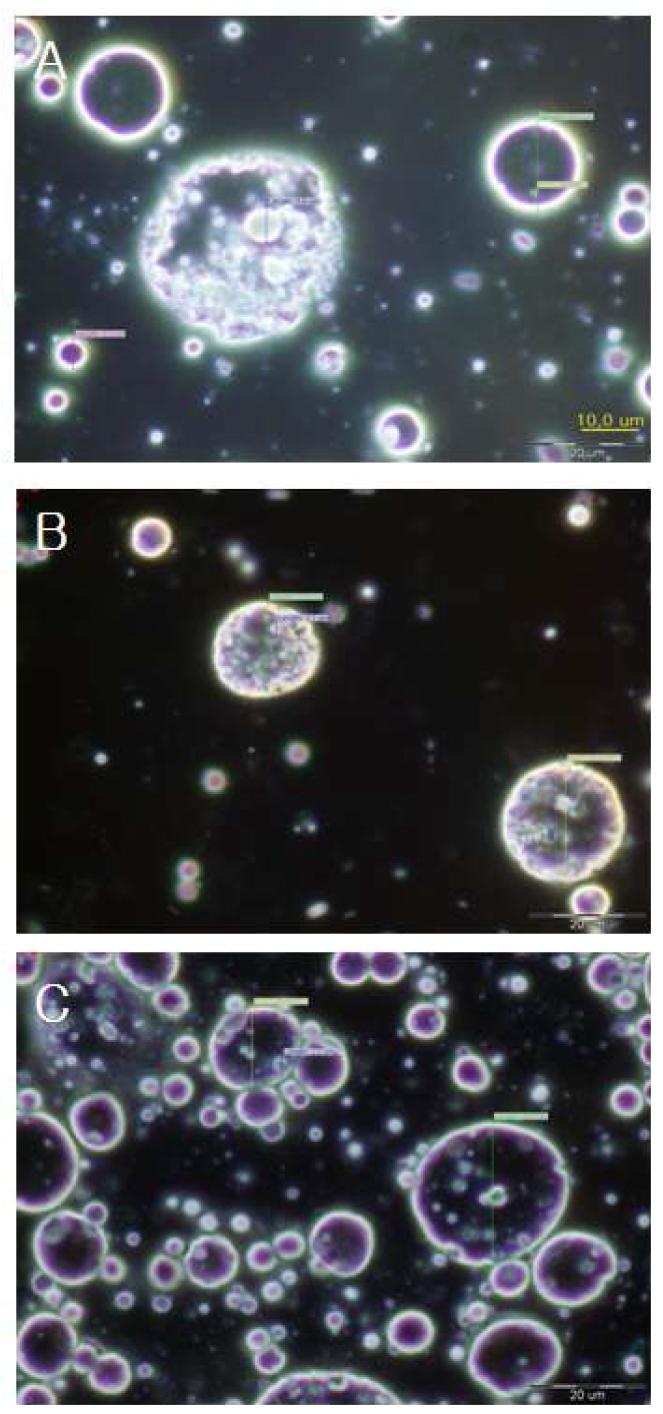 Microscope image of glycolipid surfactant cream (5)