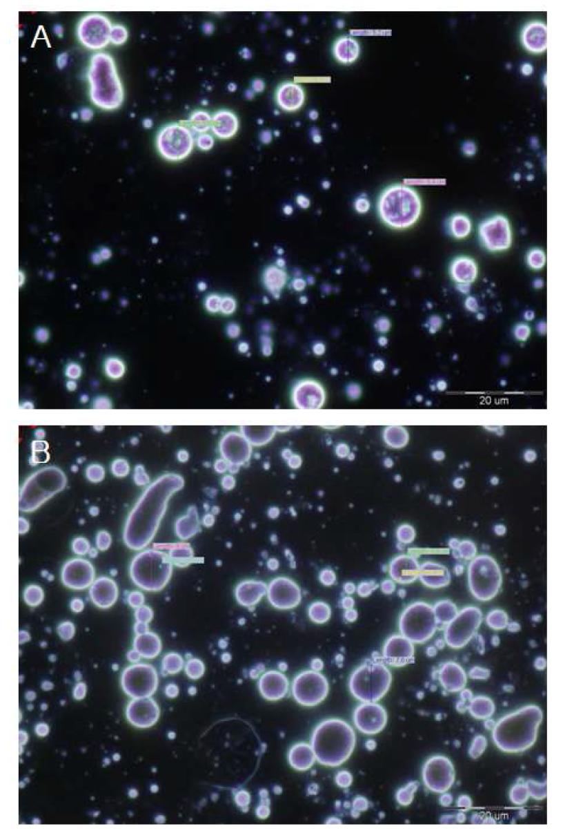 Microscope image of glycolipid surfactant cream (7)