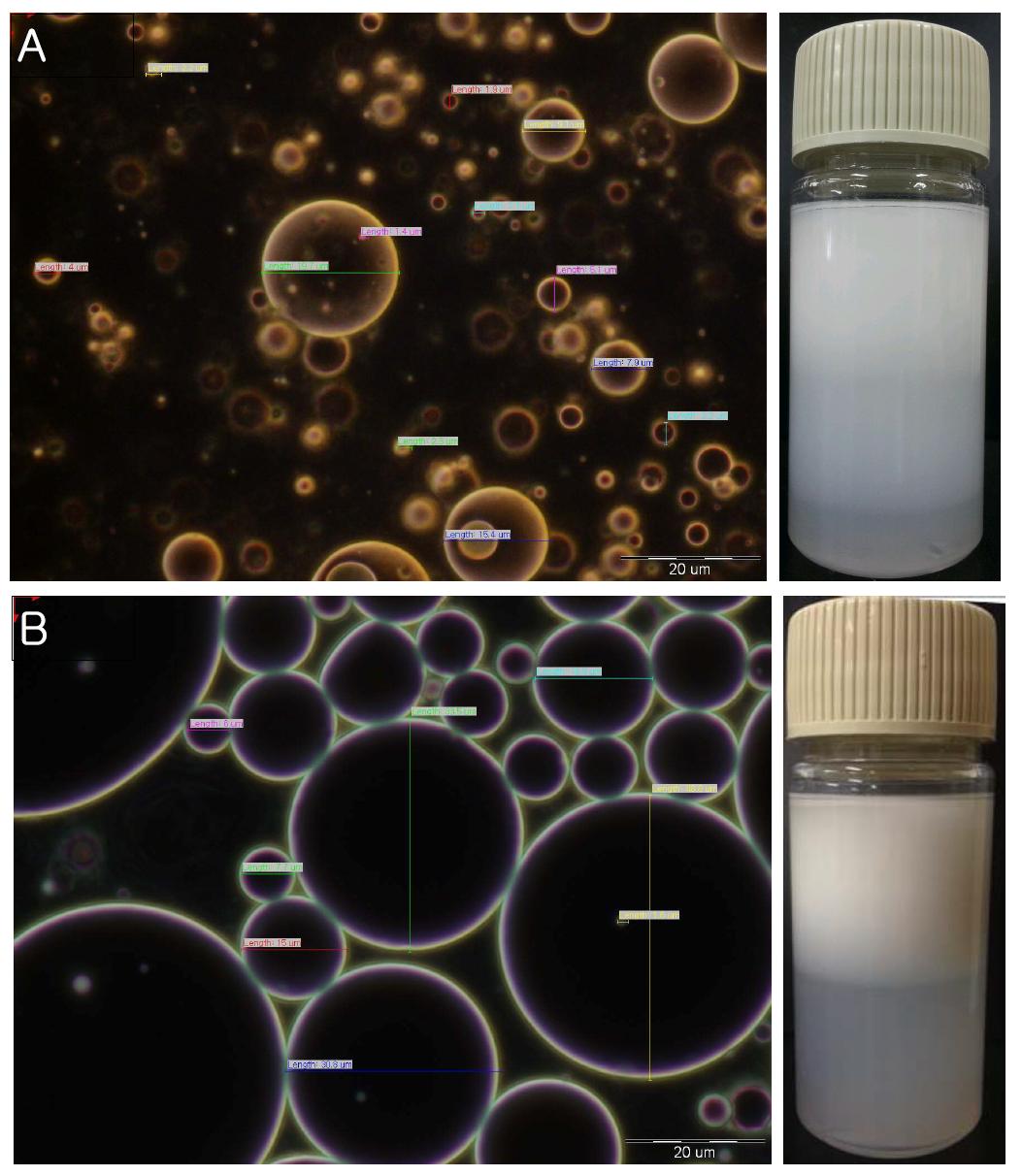 Microscope image of phospholipid surfactant cream (1)