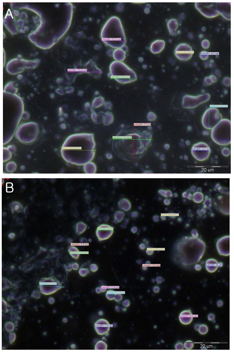 Microscope image of phospholipid surfactant cream (2)