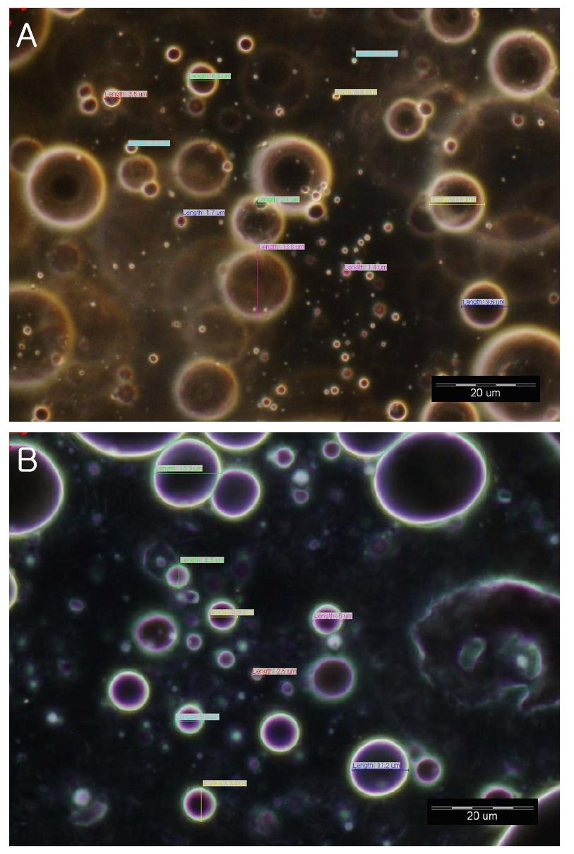 Microscope image of phospholipid surfactant cream(3)