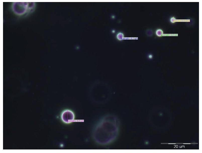 Microscope image of glycolipid surfactant & phospholipid surfactant & nonionic surfactant cream