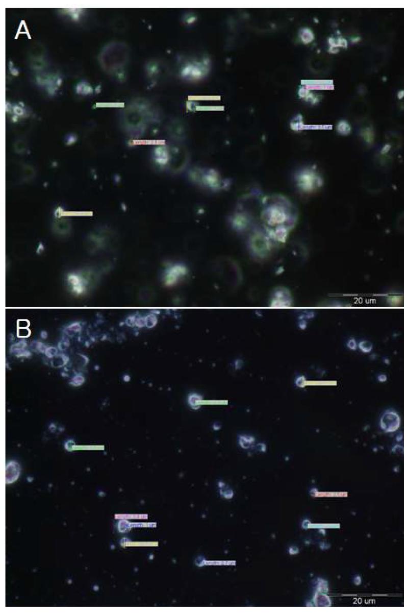 Microscope image of aminolipid surfactant & nonionic surfactant cream(1).