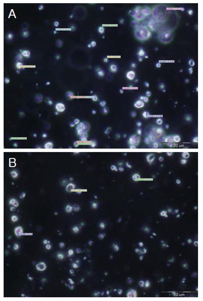 Microscope image of aminolipid surfactant & nonionic surfactant cream(2).