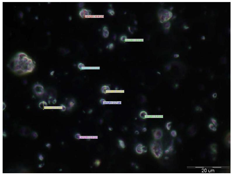 Microscope image of aminoolipid surfactant & nonionic surfactant cream (3)