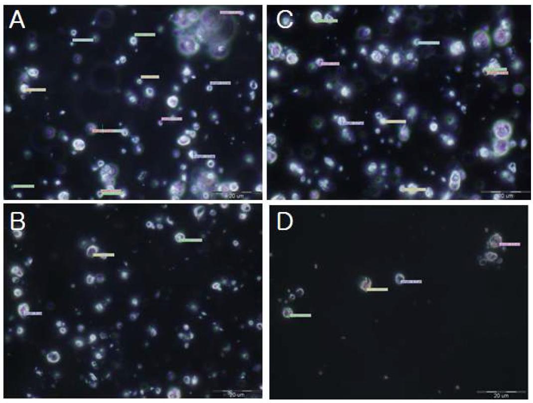 Microscope image of aminolipid surfactant & nonionic surfactant cream (4)