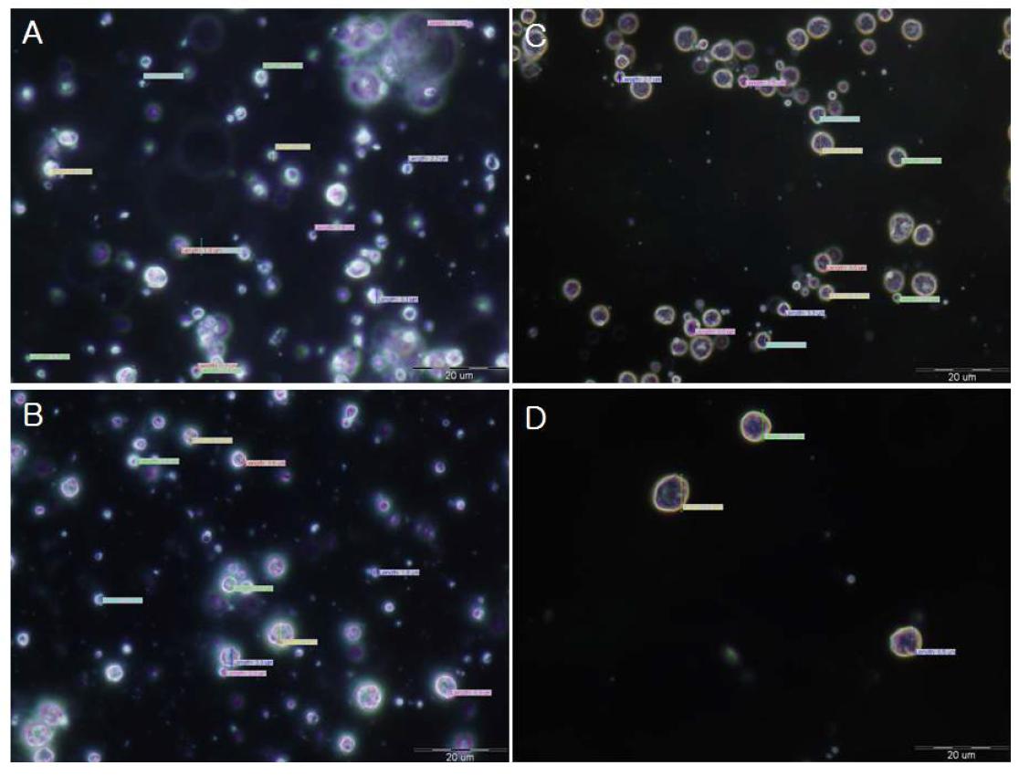 Microscope image of aminoolipid surfactant & nonionic surfactant cream (4)