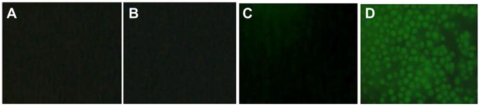 Microscopic images of (A) blank yeast cells, (B) yeast cells cultured in medium enriched with Cr3+, (C) blank yeast cells treated with sensor 1, and (D) yeast cells cultured in medium enriched with Cr3+ and then treated with sensor 1 (before performing microscopy, the cells were washed with a CH3CN/H2O(8:2, v/v, pH = 7.0) solvent mixture).