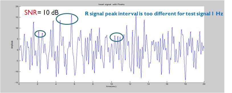 SNR 10 dB 일 때 심장 신호의 R 신호 peak 검출