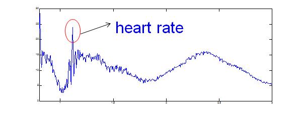 심장 박동 측정결과