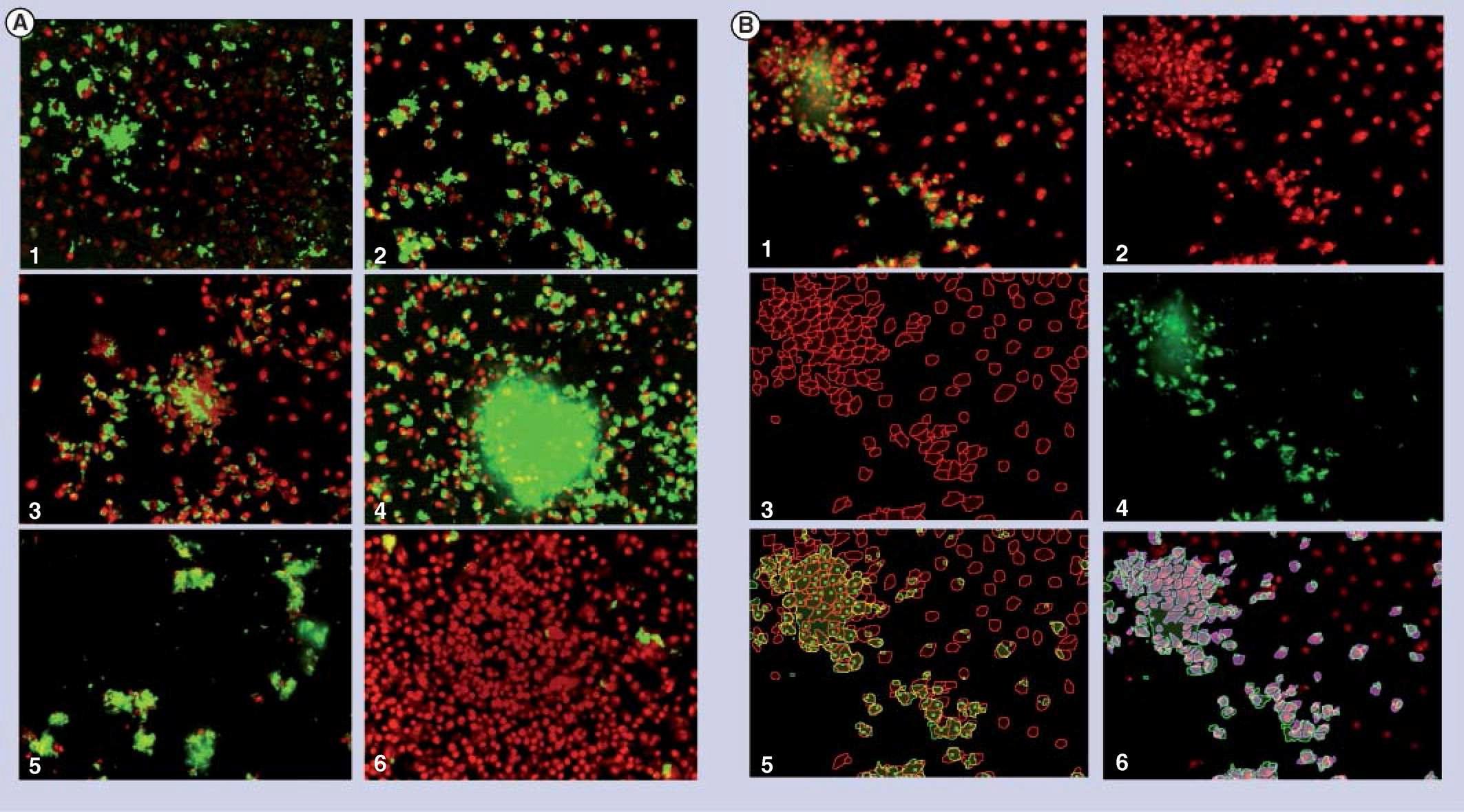 (A) GFP 발현 결핵균주를 Raw 267.4에 감염시킨 후 5일간 DMSO(1-5) 또는 INH(1uig/ml)(6)를 처리하며 배양하여 얻은 이미지. (B) 결핵균주 감염된 host cell의 이미지 마이닝 작업을 통한 분석 알고리즘 예시