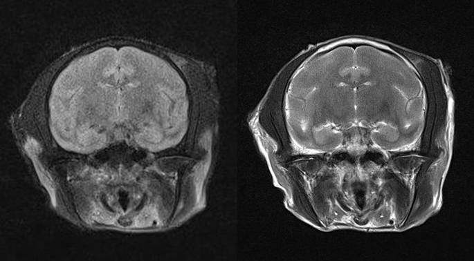 Flair and T2 coronal MRI image of Vervet, which served as the baseline database of progressive ischemic and degenerative change in aged monkey model, were obtained using 3.0T MRI.