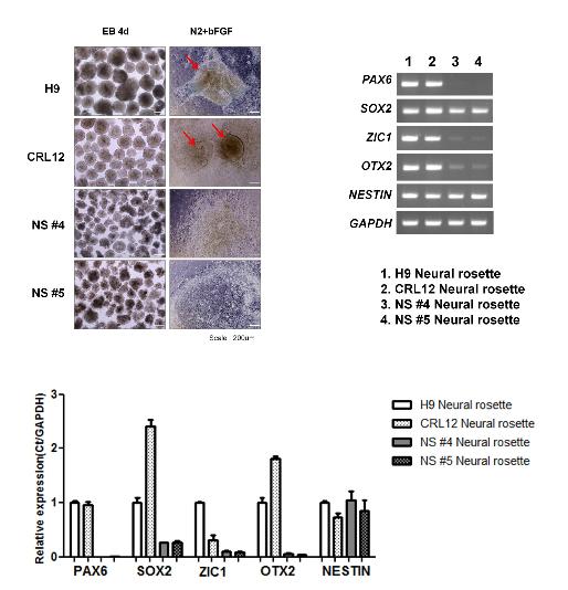 Embrynic body를 기초로 한 신경로제트로의 분화 유도