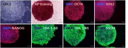 CFC 증후군 특이적 역분화줄기세포주②