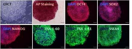 CFC 증후군 특이적 역분화줄기세포주⑦