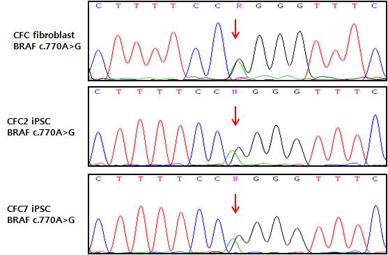 CFC 증후군 섬유화세포 및 역분화줄기세포의 돌연변이 확인