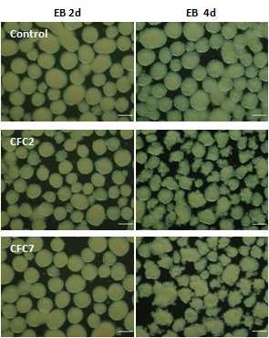 CFC 증후군 역분화줄기세포에서 보이는 EB의 morphology