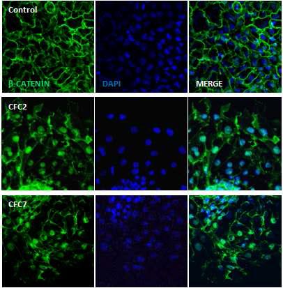 CFC 증후군 특이적 역분화줄기세포주에서 나타나는 beta catenin의 mislocalization