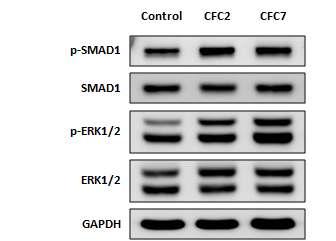 CFC 증후군 특이적 역분화줄기세포주에서 보이는 p-ERK 증가 및 p-SMAD1의 증가