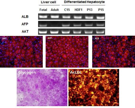 질환특이적 역분화줄기세포로부터 분화된 간세포의 기능성 확인