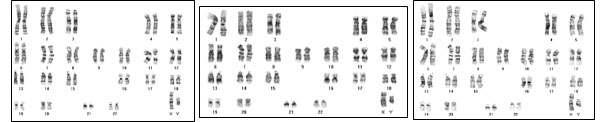 LJY 역분화줄기세포의 핵형분석