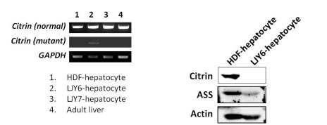 LJY-hepatocyte에서의 시트린 결손/발현
