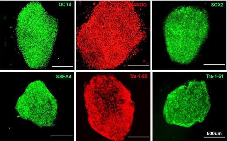 파브리병 유래의 역분화 줄기세포에서 배아줄기세포 특이적 유전자 및 단백질 발현
