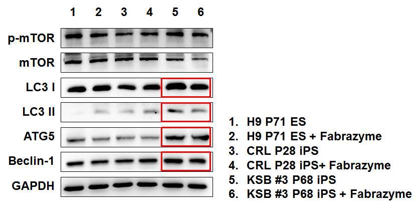 파브리병 내에서 Autophagy formation에 영향을 미치는 단백질 양 조사