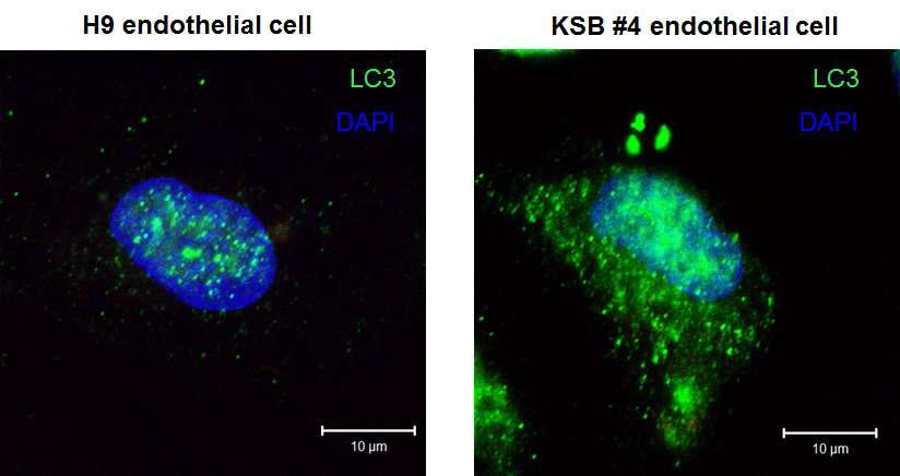 파브리병 환자 유래의 역분화 줄기세포에서 분화된 혈관내피세포에서 Autophagy 특이적 마커인 LC3의 양을 확인