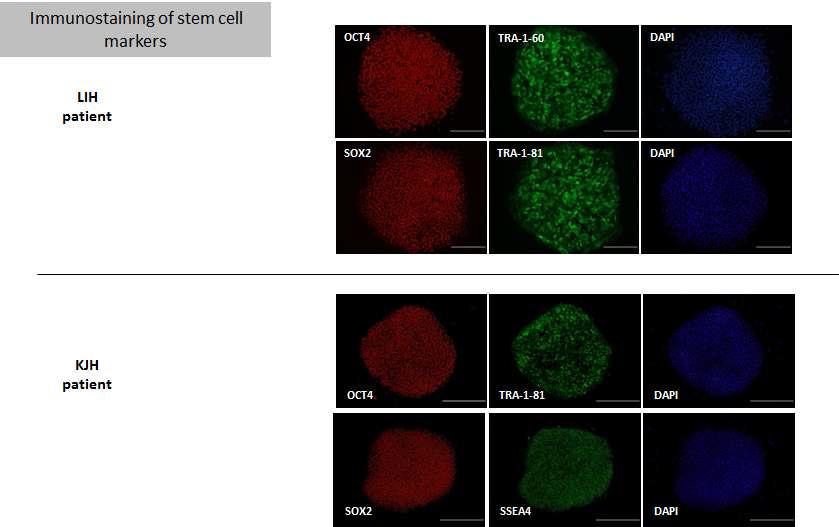 OTC 결핍증 환자(LIH, KJH) 역분화줄기세포에서의 줄기세포 특이적 단백질 발현