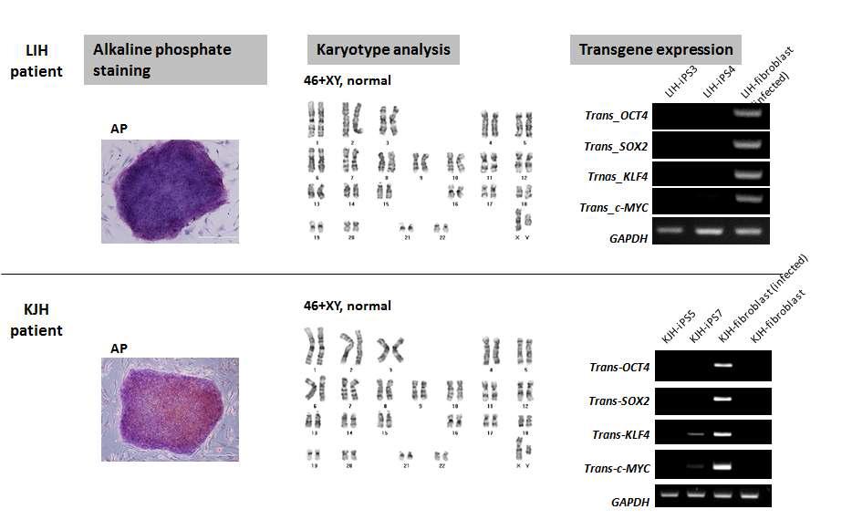 OTC 결핍증 환자(LIH, KJH) 역분화줄기세포에서의 alkaline phosphatase staining, 핵형분석, transgene 발현여부 확인