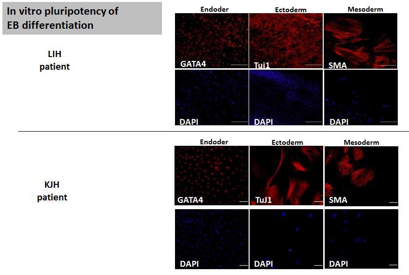 OTC 결핍증 환자(LIH, KJH) 역분화줄기세포에서의 in vitro 분화능 확인