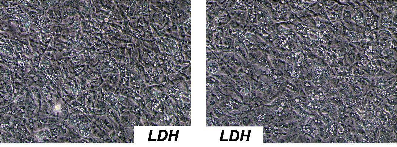 LDH-역분화줄기세포로부터 분화된 간세포의 모습