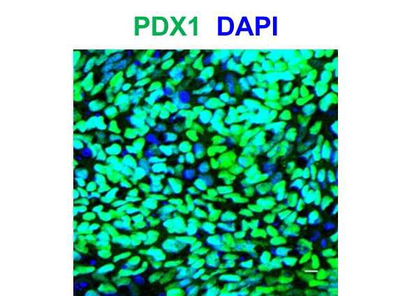 진정 내배엽 특이적 전사 인자인 PDX1의 단백질 수준 발현 확인 (scale bar : 10 um)
