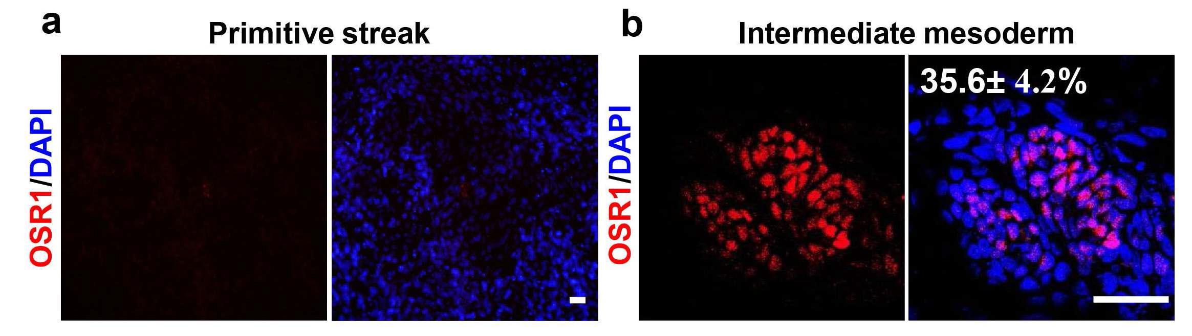 인간 배아 줄기세포 유래의 중간 중배엽 세포에서 특이마커 유전자인 OSR1의 면역형광염색에서의 발현 결과