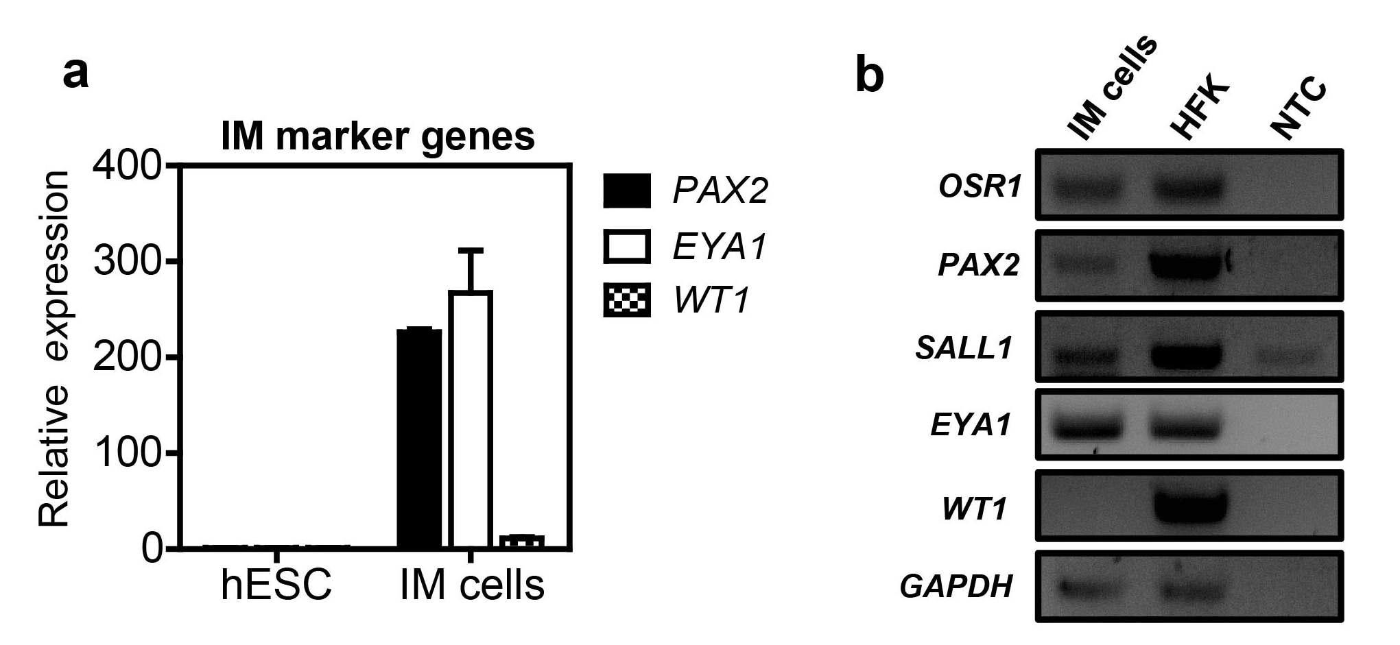 인간 배아 줄기세포 유래의 중간 중배엽 세포에서 OSR1 이외의 특이마커 유전자의 발현 결과